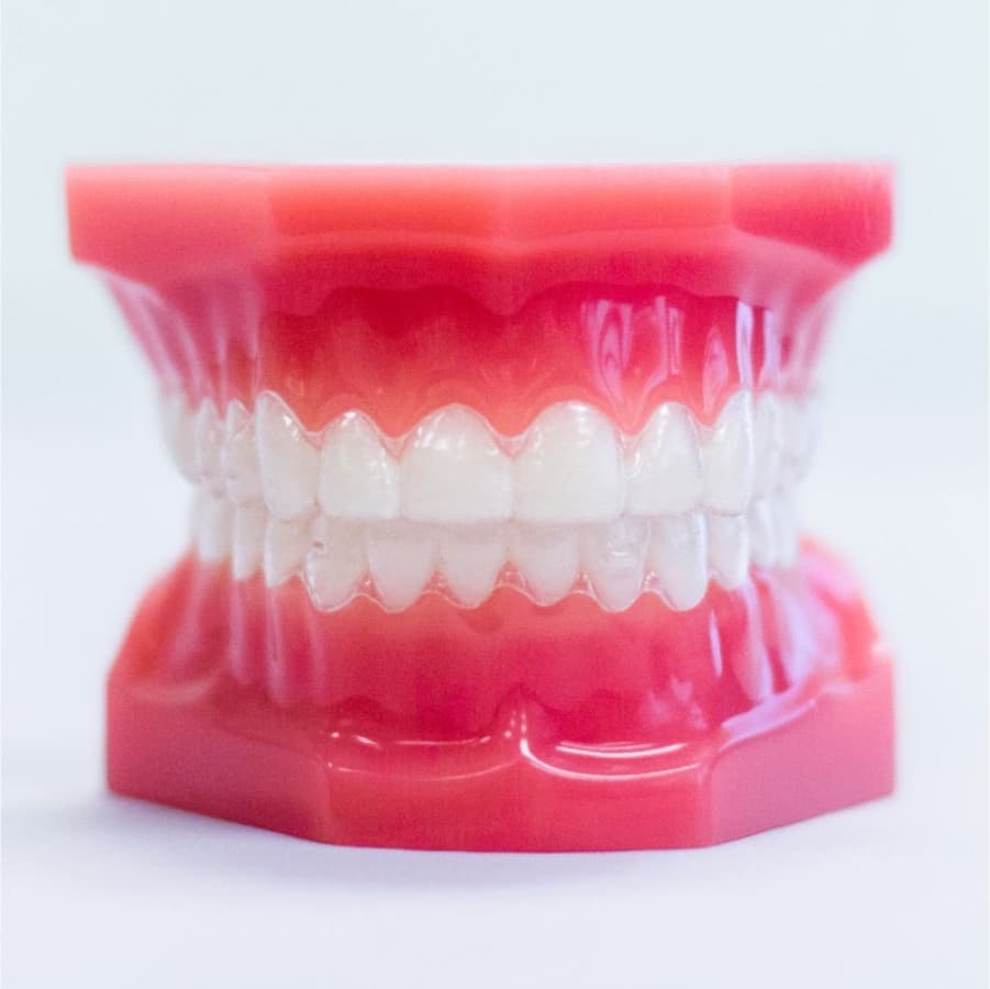 Invisalign aligners on plastic model