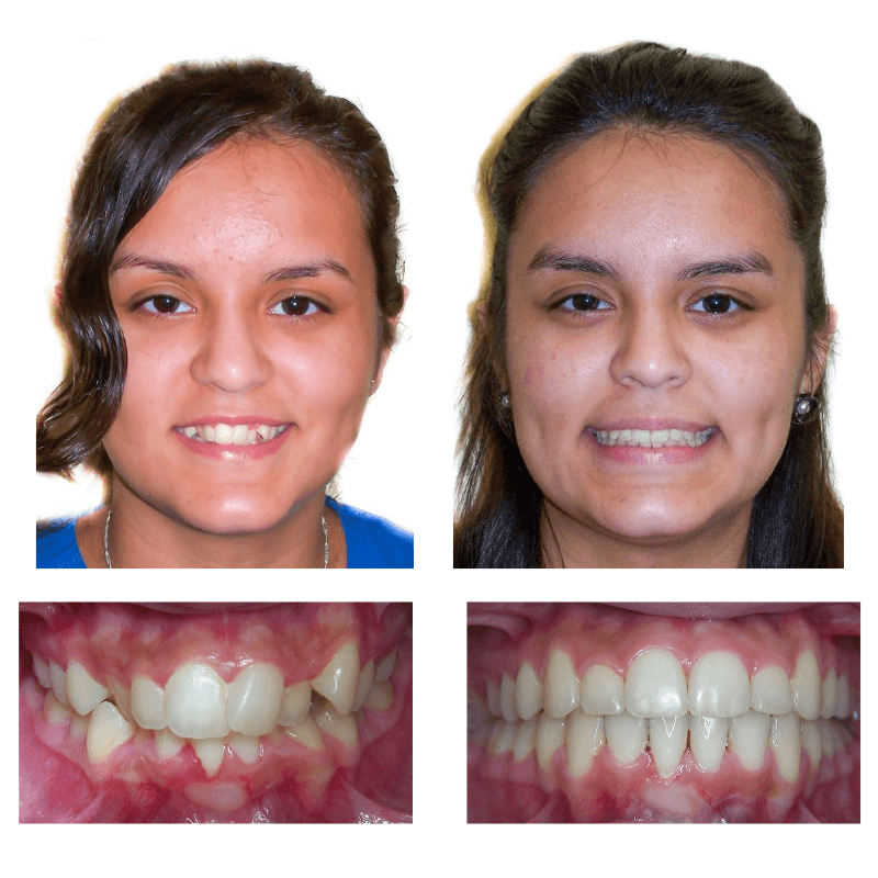 FHO-Smile-Transformations-1-1