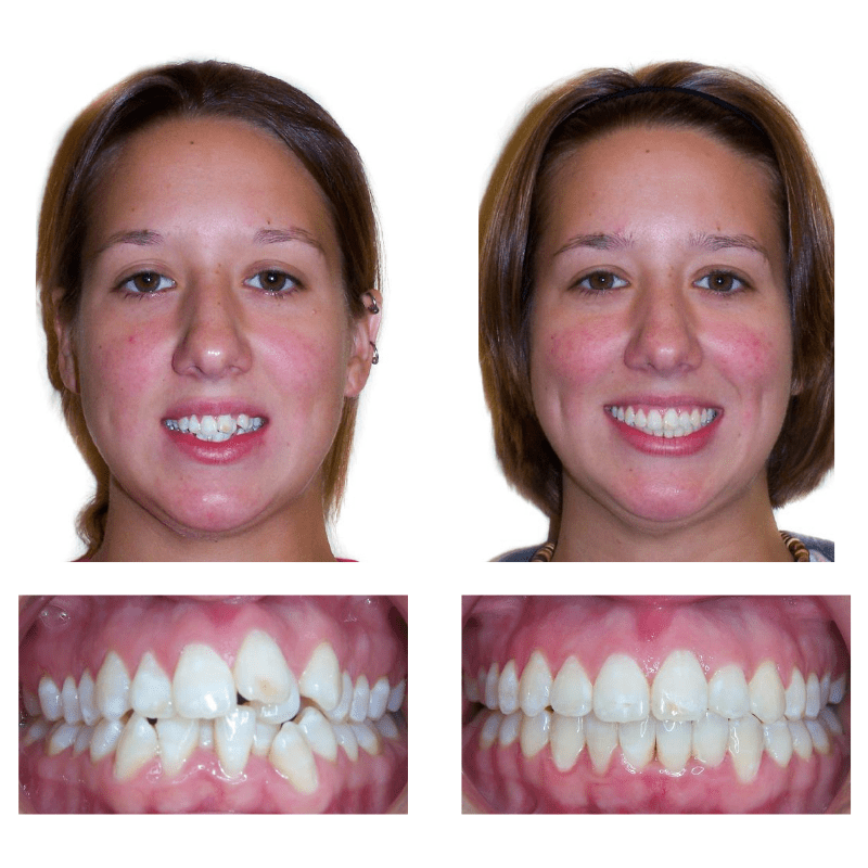 FHO-Smile-Transformations-1
