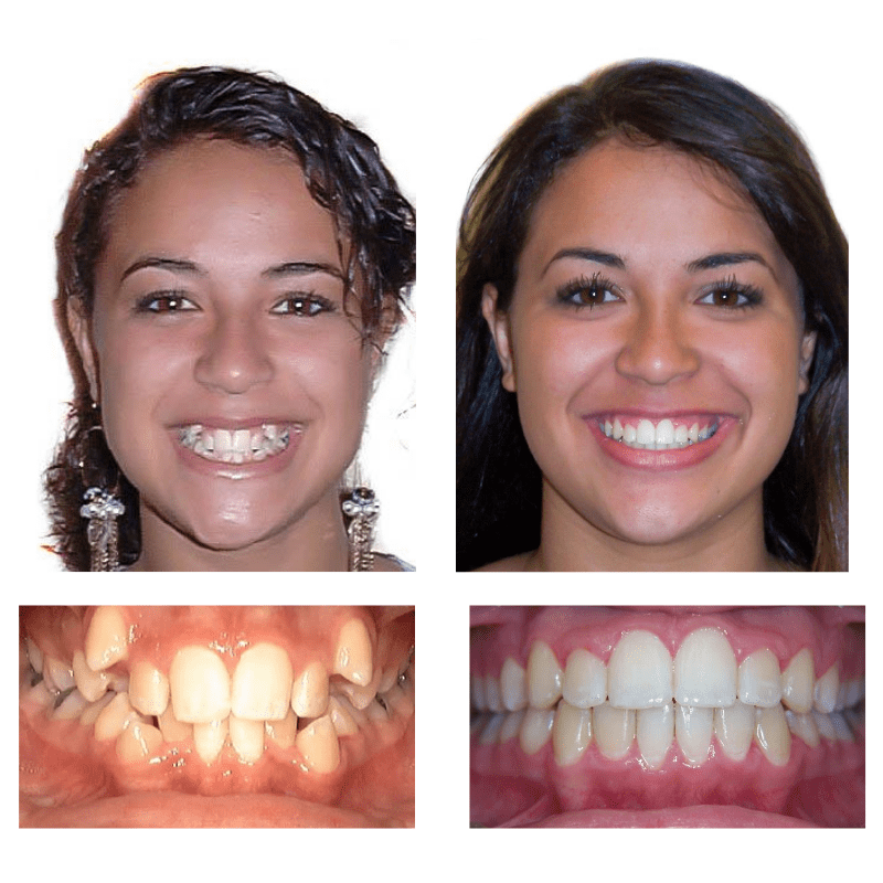 FHO-Smile-Transformations-2-1