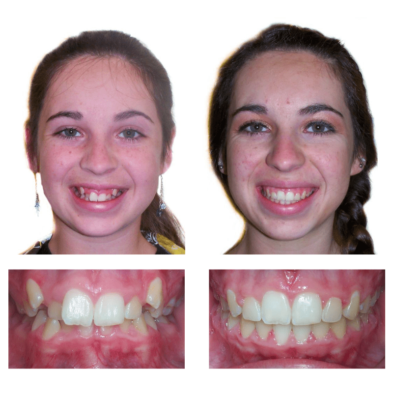 FHO-Smile-Transformations-2-2