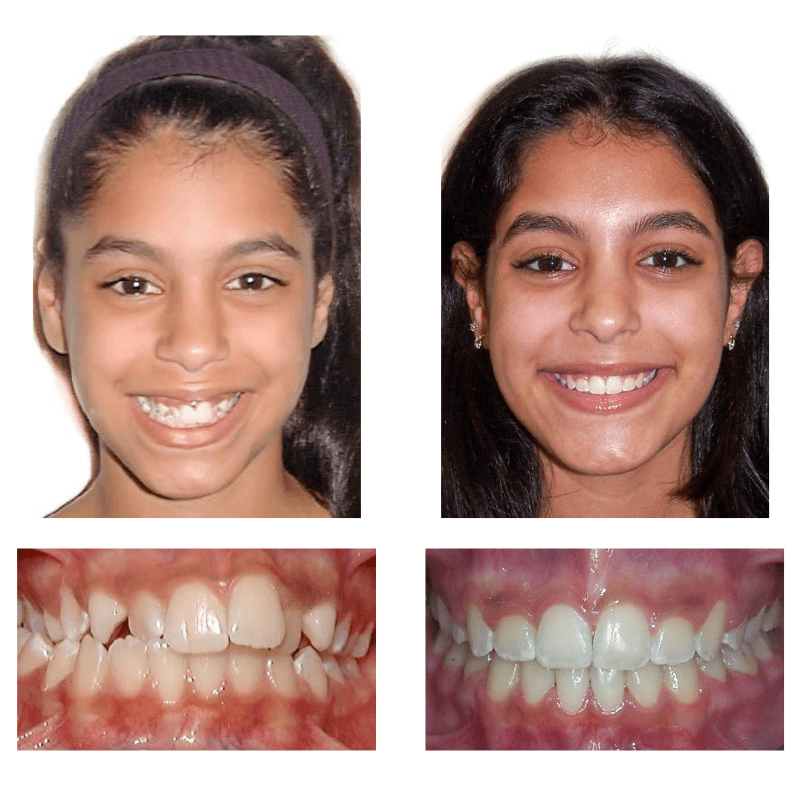 FHO-Smile-Transformations-2