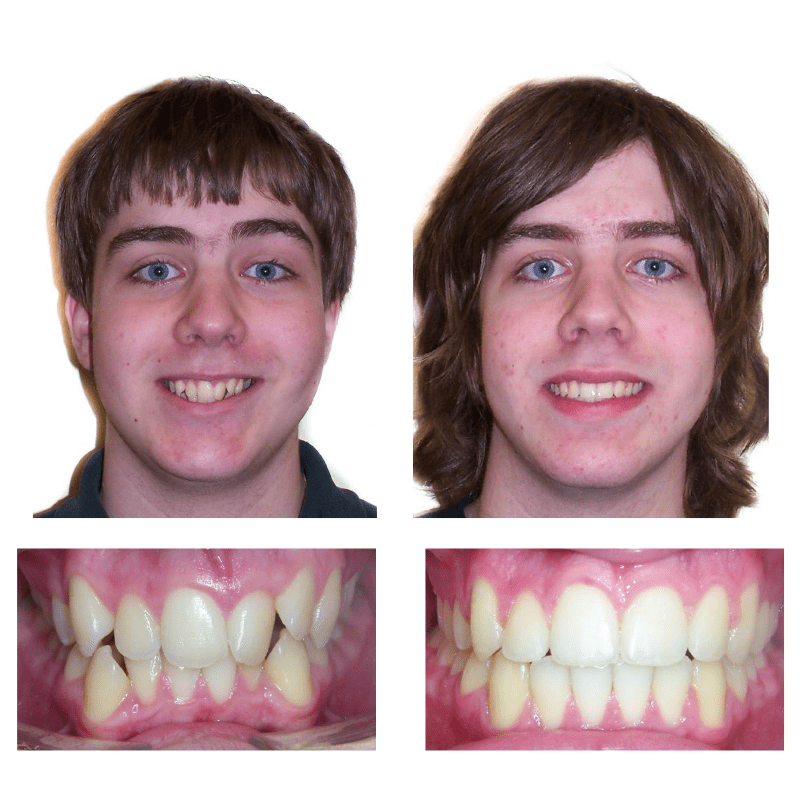 FHO-Smile-Transformations-3