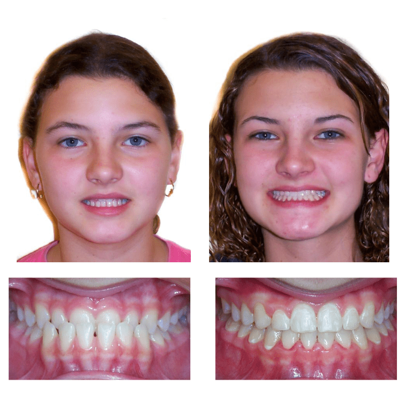 FHO-Smile-Transformations-4
