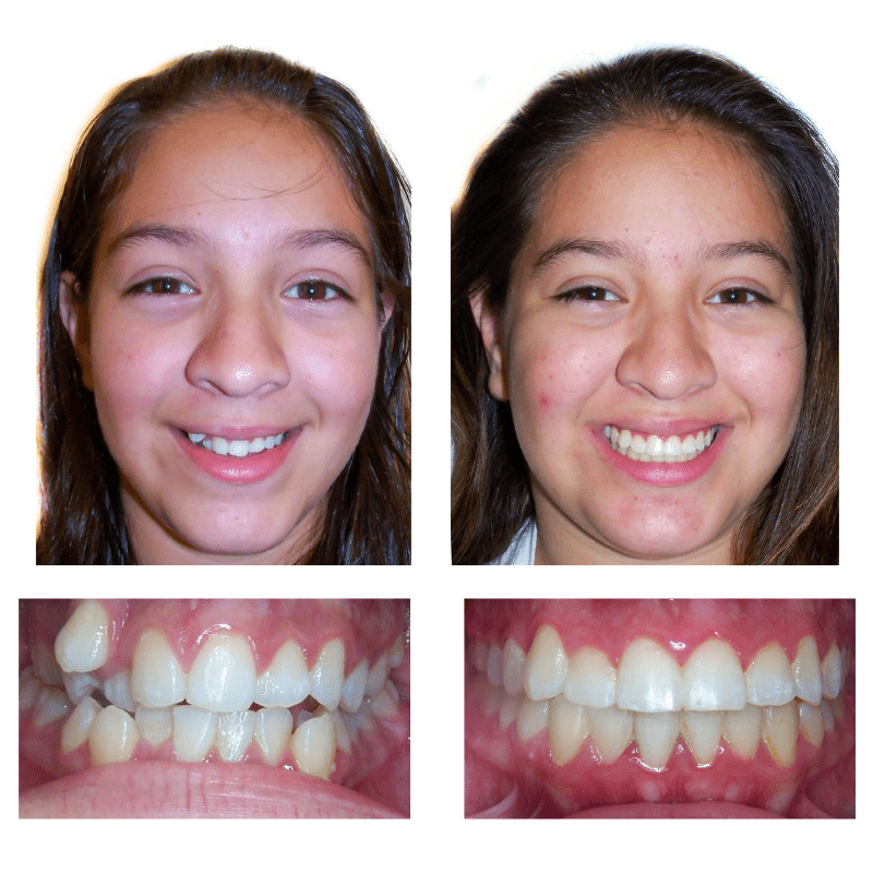 FHO-Smile-Transformations-5