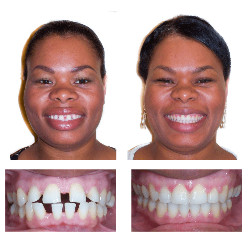 FHO-Smile-Transformations-6
