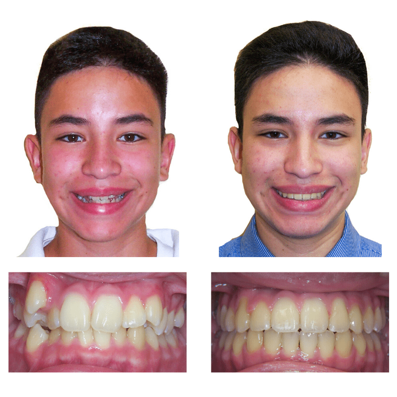 FHO-Smile-Transformations_-Martin-Web