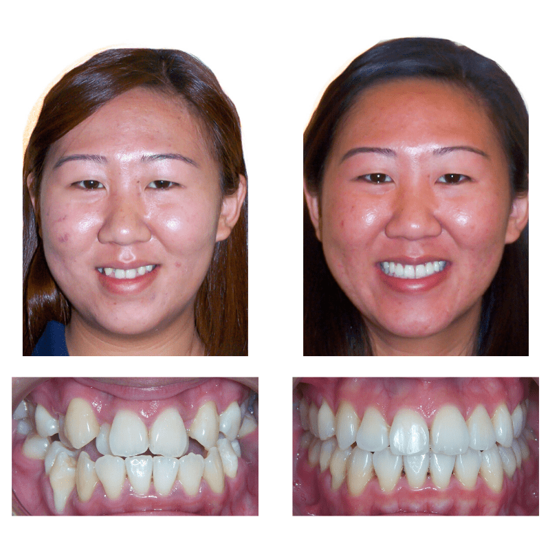 FHO-Smile-Transformations_-Thulee-Web