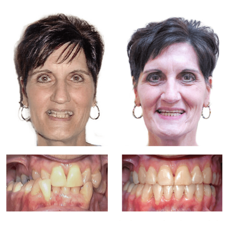FHO-Smile-Transformations_Karen-1