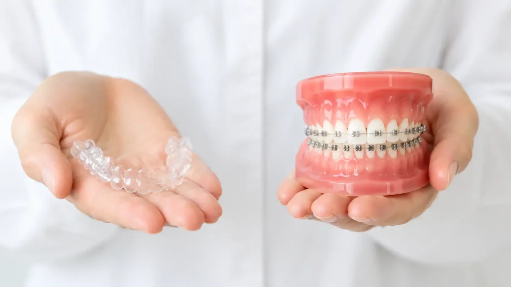 Clear Aligner vs Braces Comparison